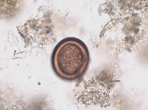 Cestodos, clase Cestoda, género Echinococcus