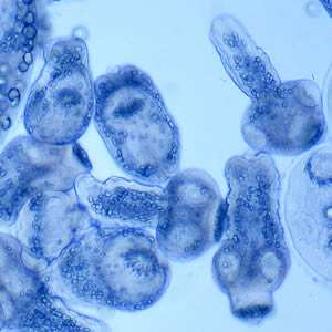 Echinococcus, equinococos, Echinococcus granulosus