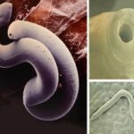 Morfología de los nematodos