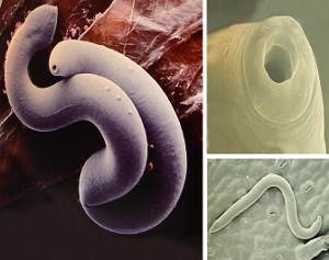 Morfología de los nematodos