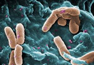 Vibrionaceae y Pseudomona: bacterias Gram-negativas causantes de enfermedades