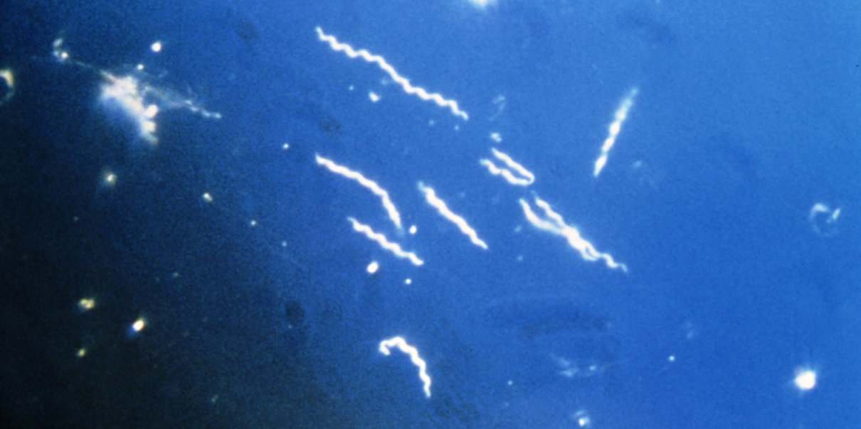 Borrelia burgdorferi, patógeno que causa la enfermedad de Lyme