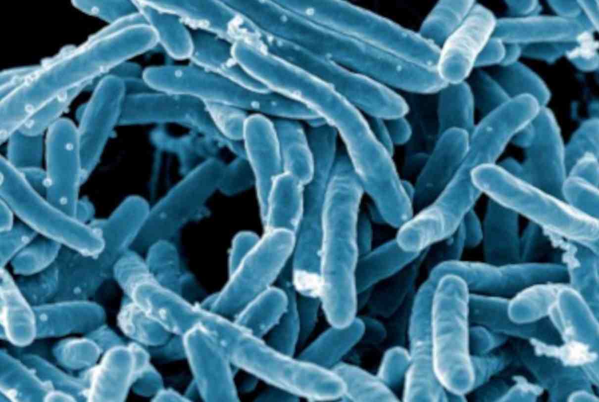 Tuberculosis (enfermedad de Koch) una infección reemergente